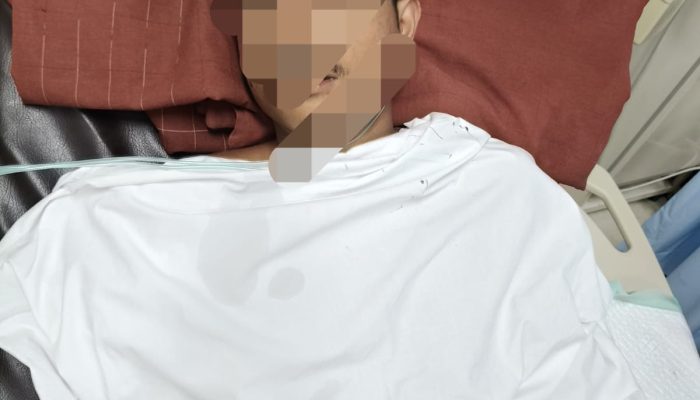 Begal Sadis di Jalan Bougenville, Pelajar SMK Dibacok Hingga Pergelangan Tangan Putus